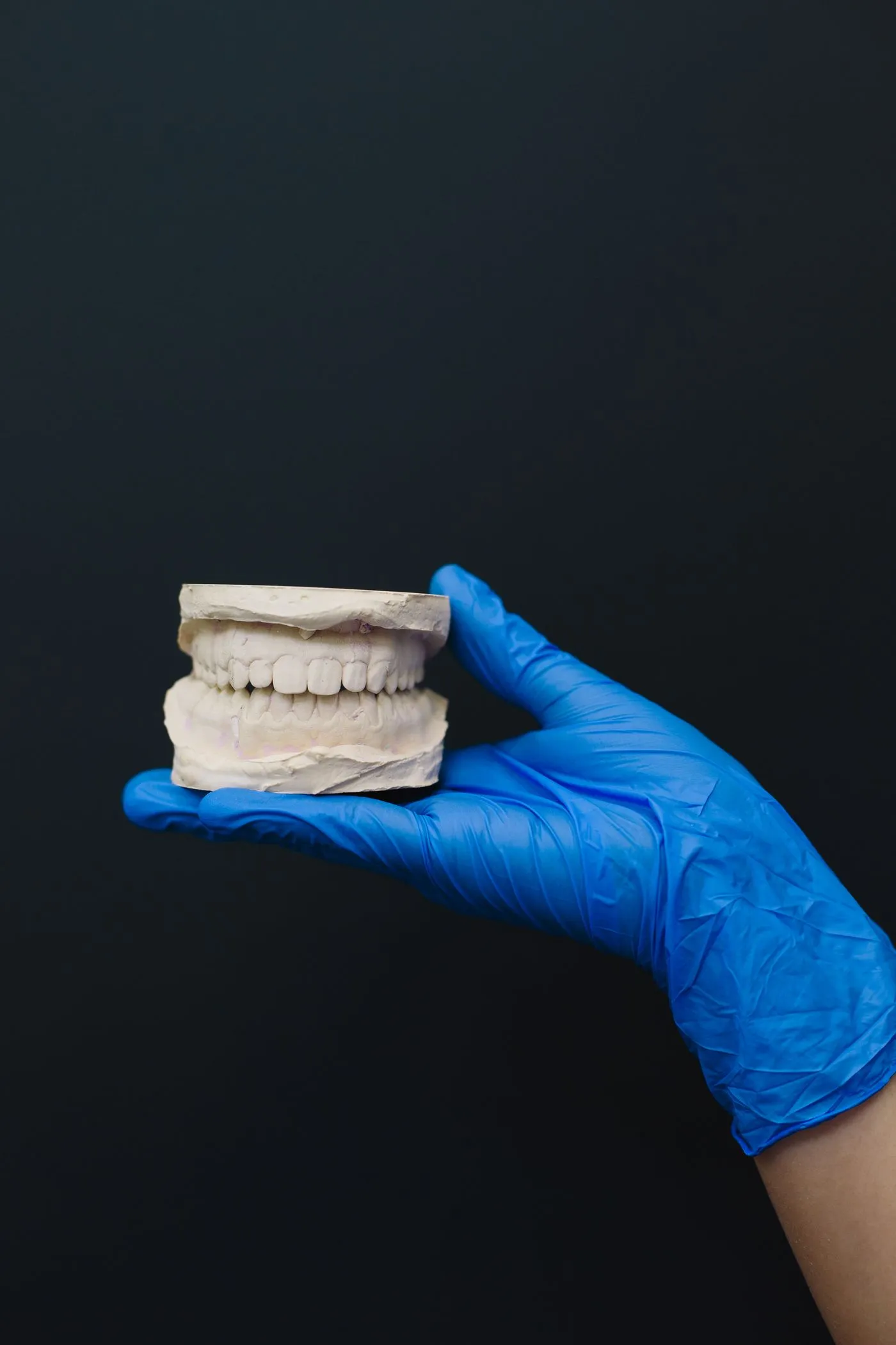 A gloved hand holding a plaster model of the upper and lower teeth